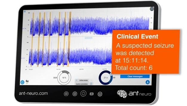 nëo™ aEEG Monitör